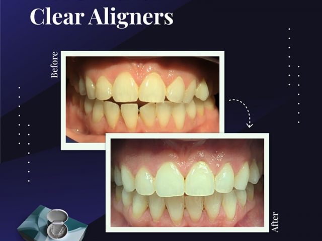 https://bridgeofdondental.co.uk/wp-content/uploads/2025/08/481173945_122211737204206679_8324364517682390772_n-640x480.jpg