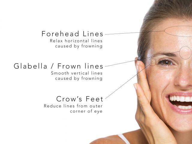 https://bridgeofdondental.co.uk/wp-content/uploads/2026/05/Botox-link-640x480.jpg