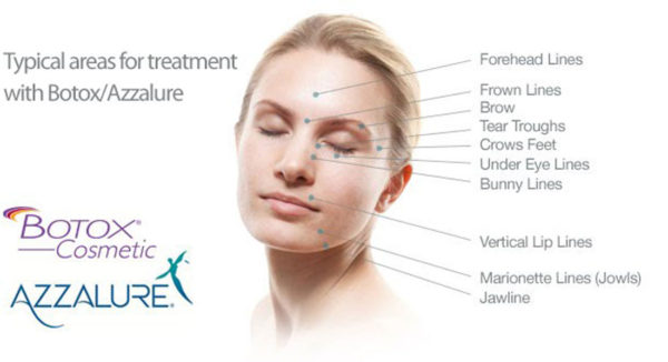 https://bridgeofdondental.co.uk/wp-content/uploads/2026/05/Facial-Aesthetics-Botox-600x326-1.jpg