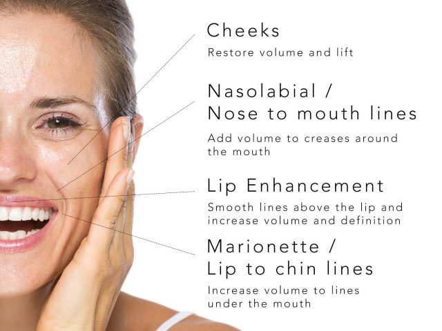 https://bridgeofdondental.co.uk/wp-content/uploads/2026/05/Fillers-areas-1-640x480.jpg